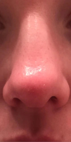 After