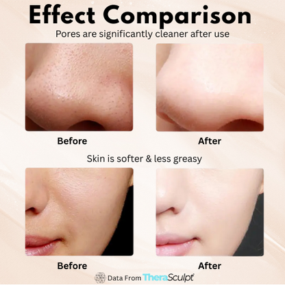 DermaPulse® Ultrasonic Skin Spatula